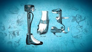 Orthopedics